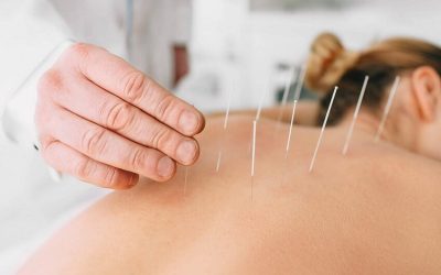 acupuntura-850x560